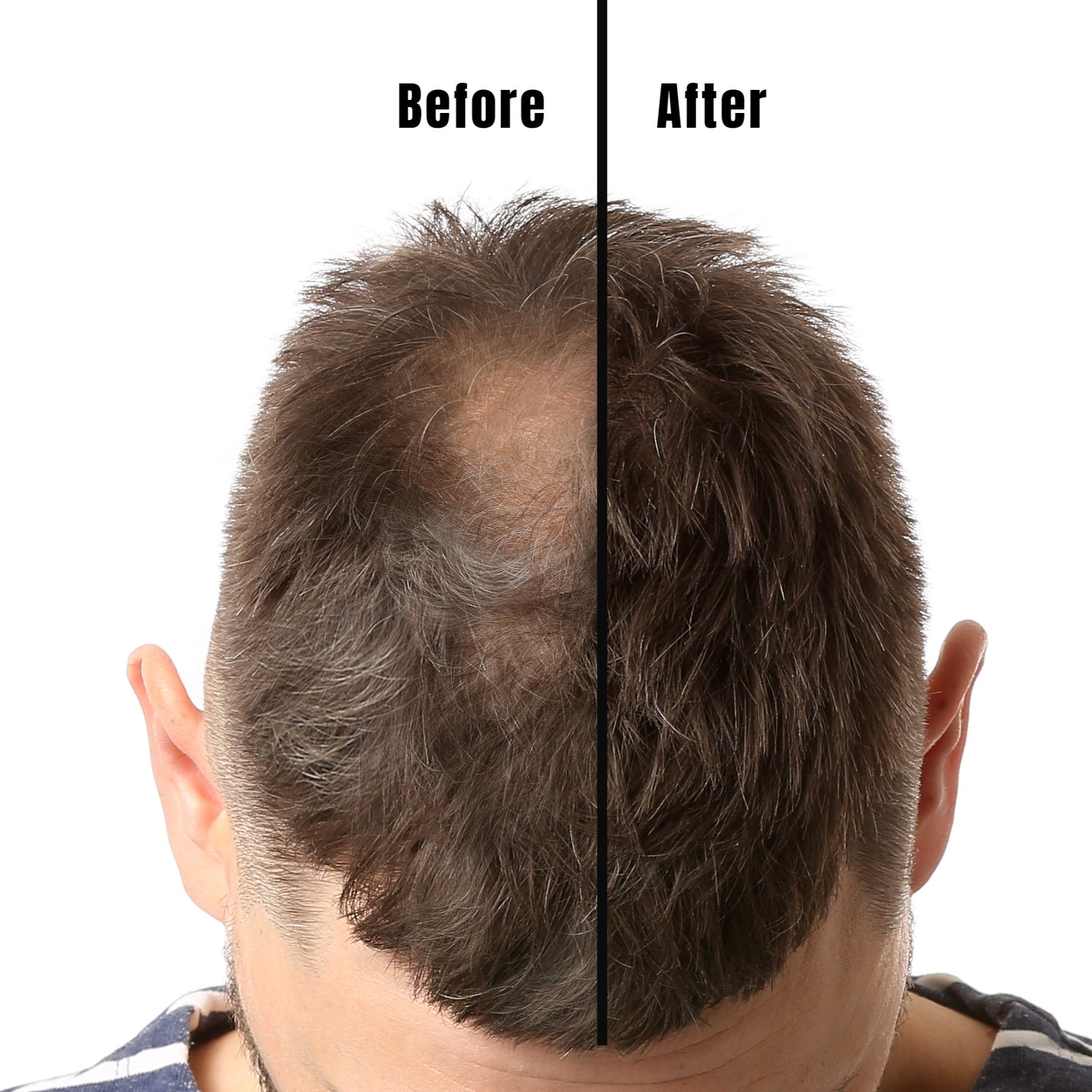 Buy Hairgrow 5% Minoxidil Solution 50 ml Online at Best prices in Qatar |  CarenCure pharmacy