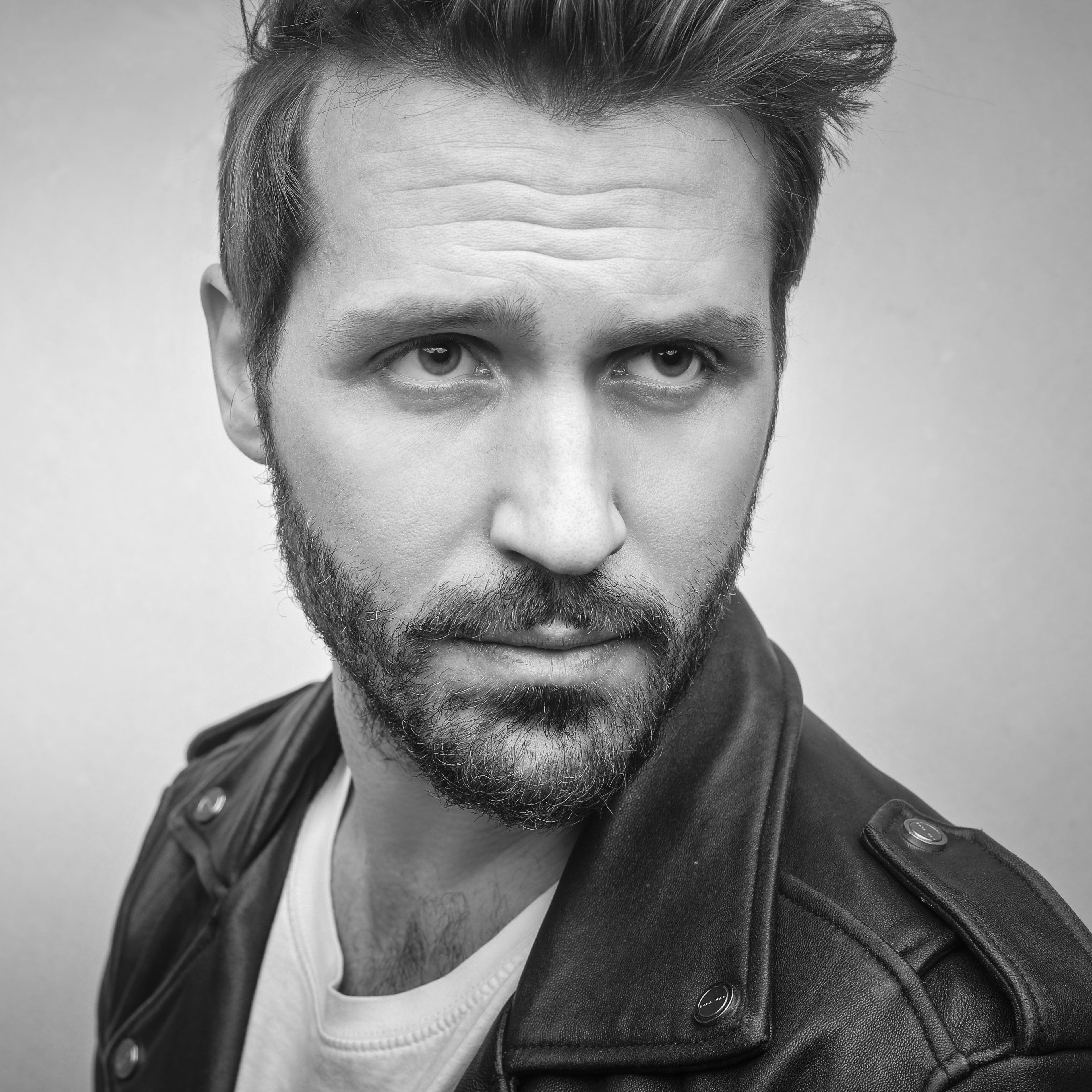 Does Alpha Lipoic Acid Cause Hair Loss? Examining the Evidence