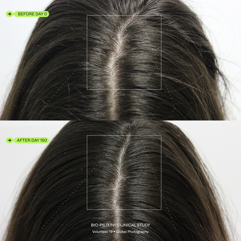 Before and after results, volunteer 19