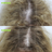 Before and after results, volunteer 3
