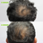 Before and after results, volunteer 30