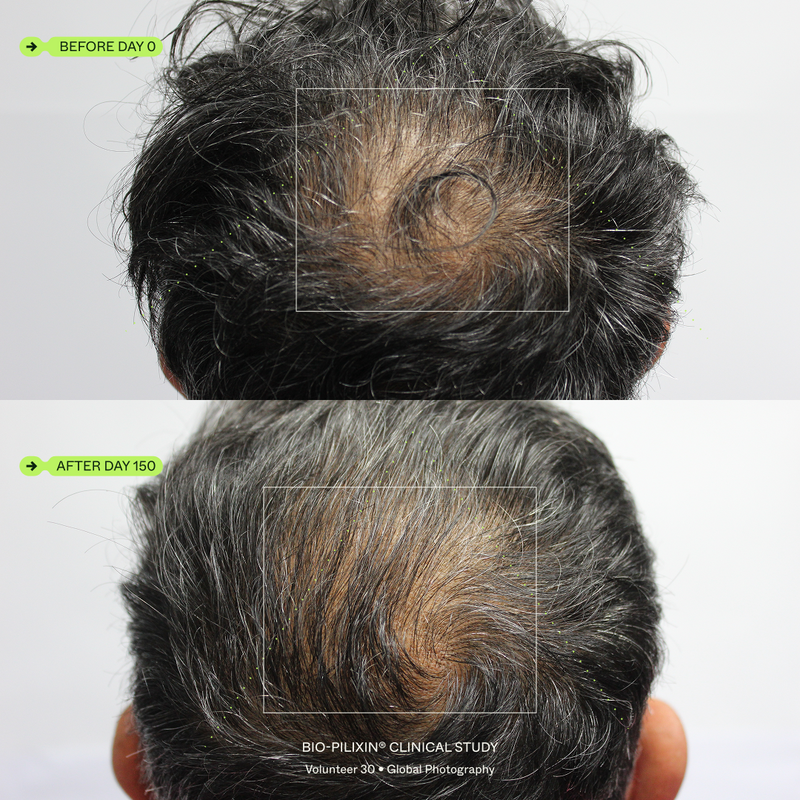 Before and after results, volunteer 30