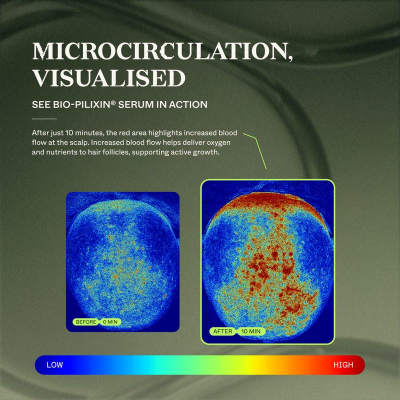 Measure of microcirculation
