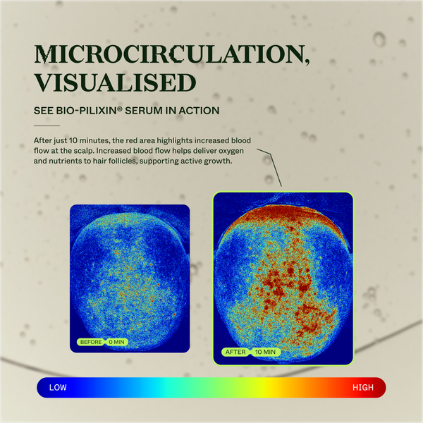 Measure of microcirculation