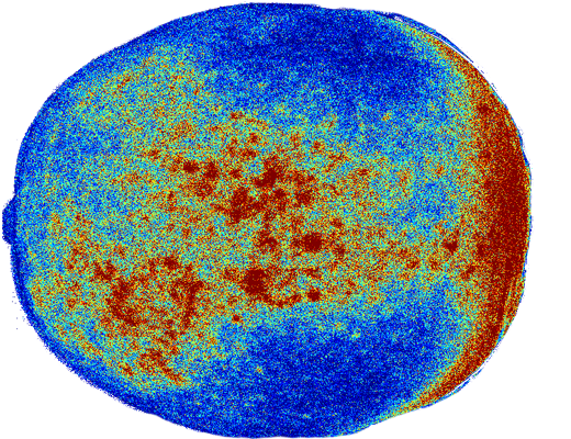 Laser perfusion image after HotFlux application