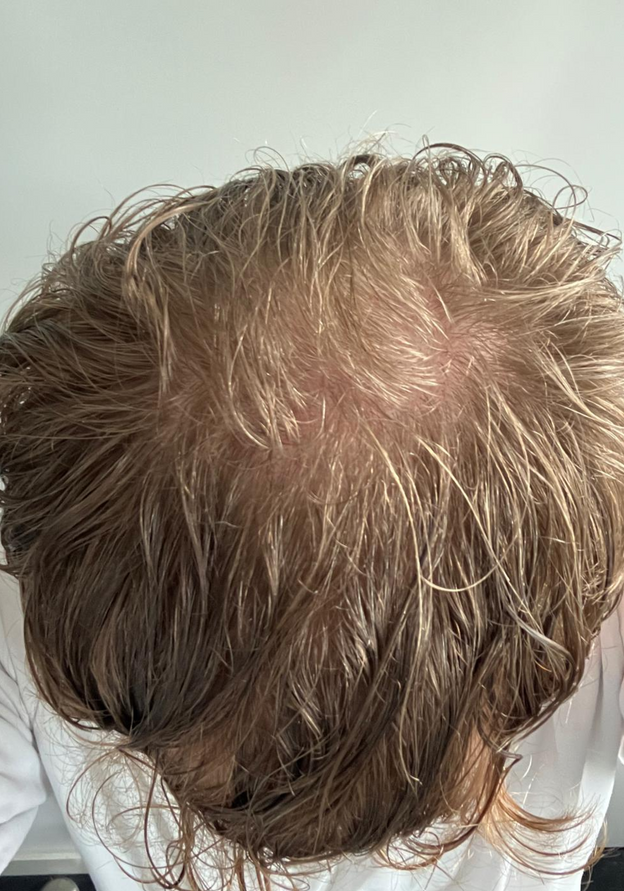 After - Sean