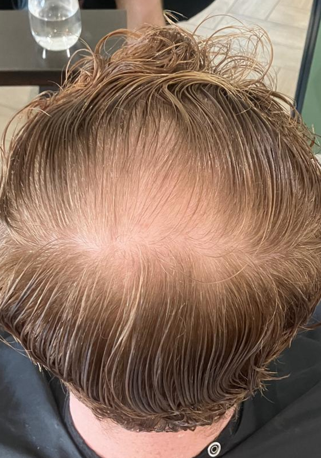 Before - Sean