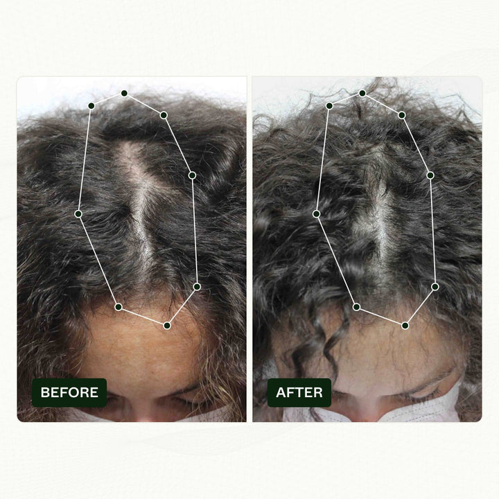 woman hair loss before and after