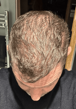 Rick testimonial before