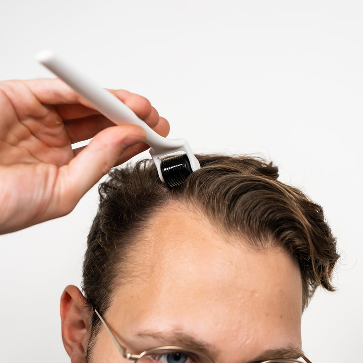 microneedling for hair loss